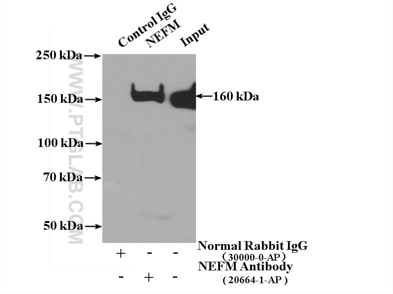 IP experiment of rat brain using 20664-1-AP