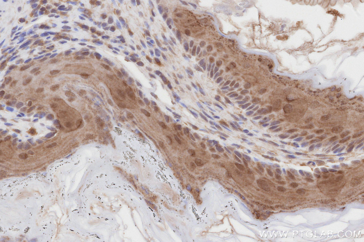 IHC staining of mouse stomach using 27146-1-AP IHC staining of mouse stomach using 27146-1-AP