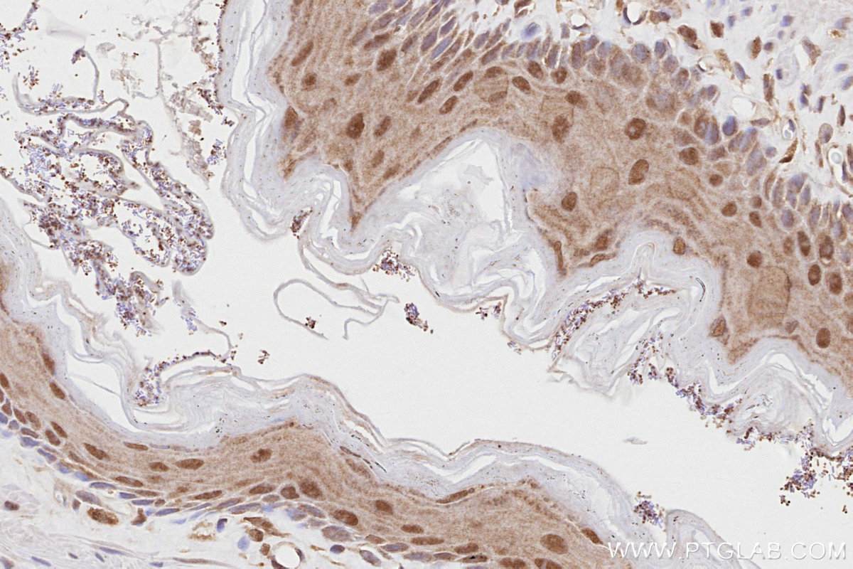 IHC staining of rat stomach using 27146-1-AP IHC staining of rat stomach using 27146-1-AP