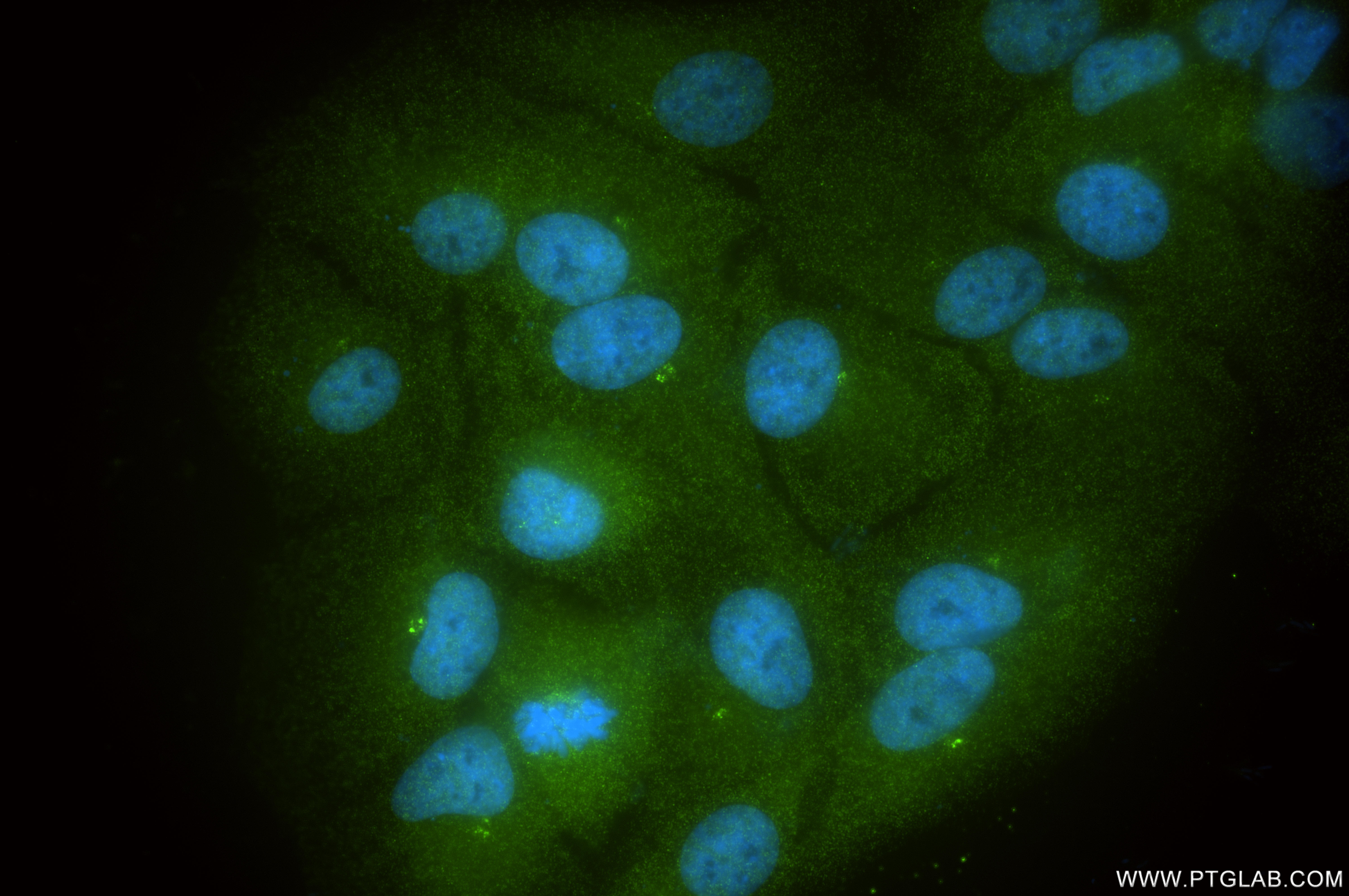 IF Staining of hTERT-RPE1 using 86224-2-RR (same clone as 86224-2-PBS)