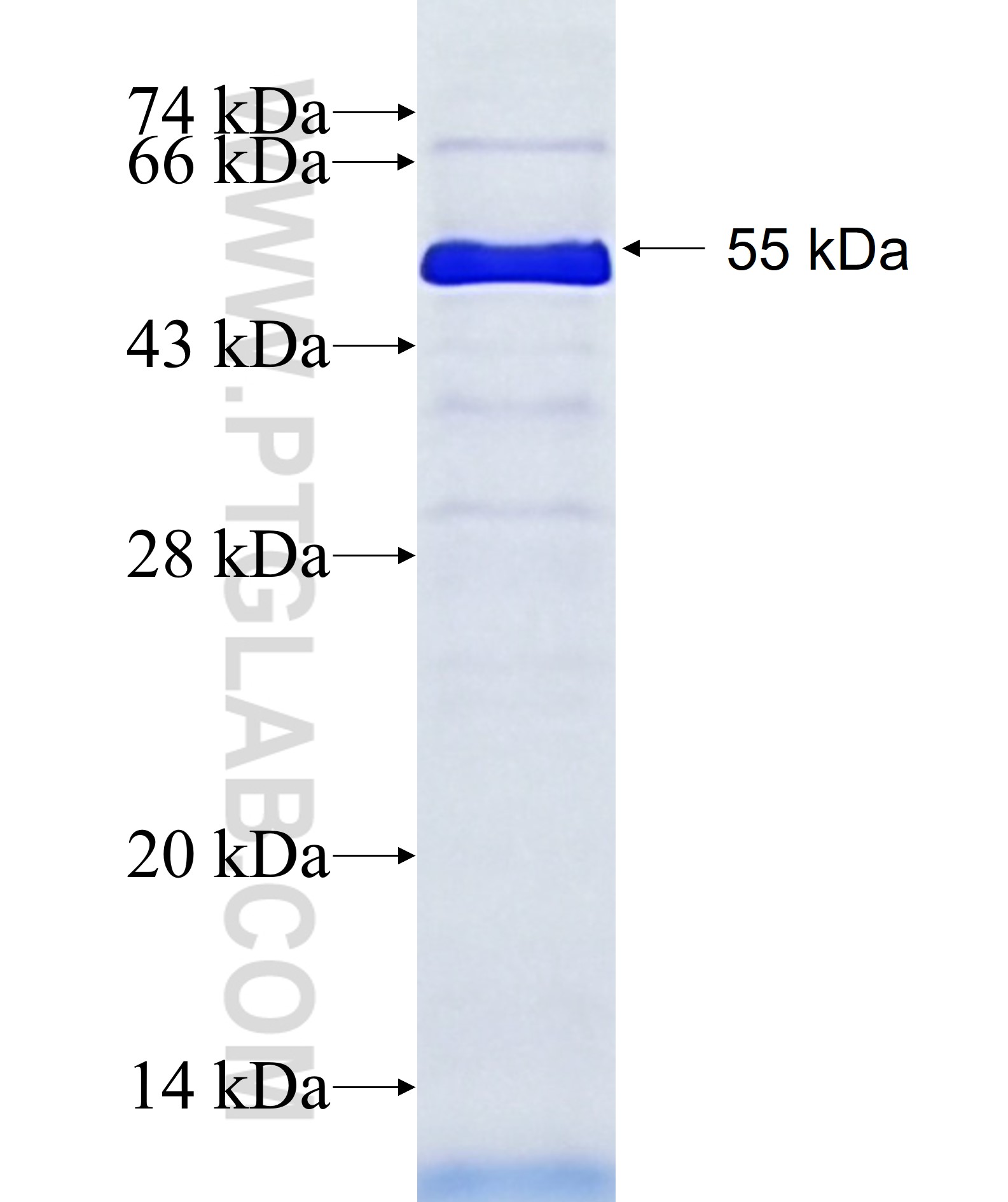 NEK10 fusion protein Ag11640 SDS-PAGE