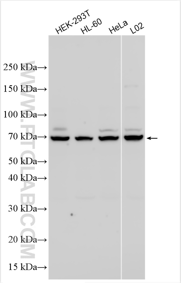 WB analysis using 12710-1-AP