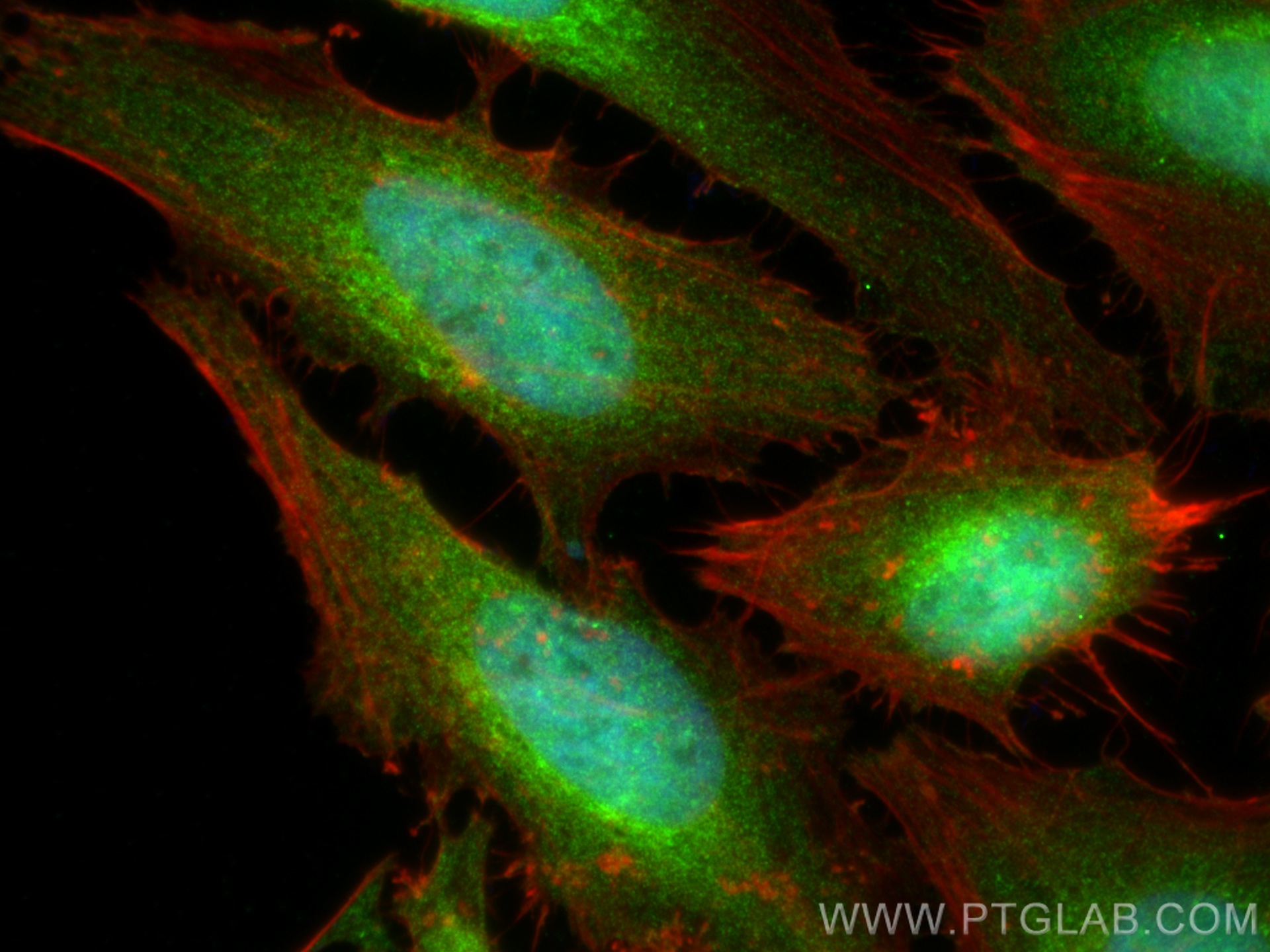 IF Staining of HeLa using 24171-1-AP