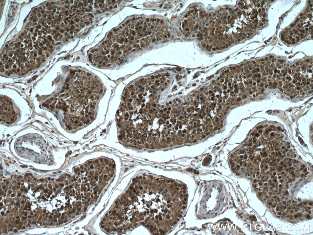 IHC staining of human testis using 66632-1-Ig