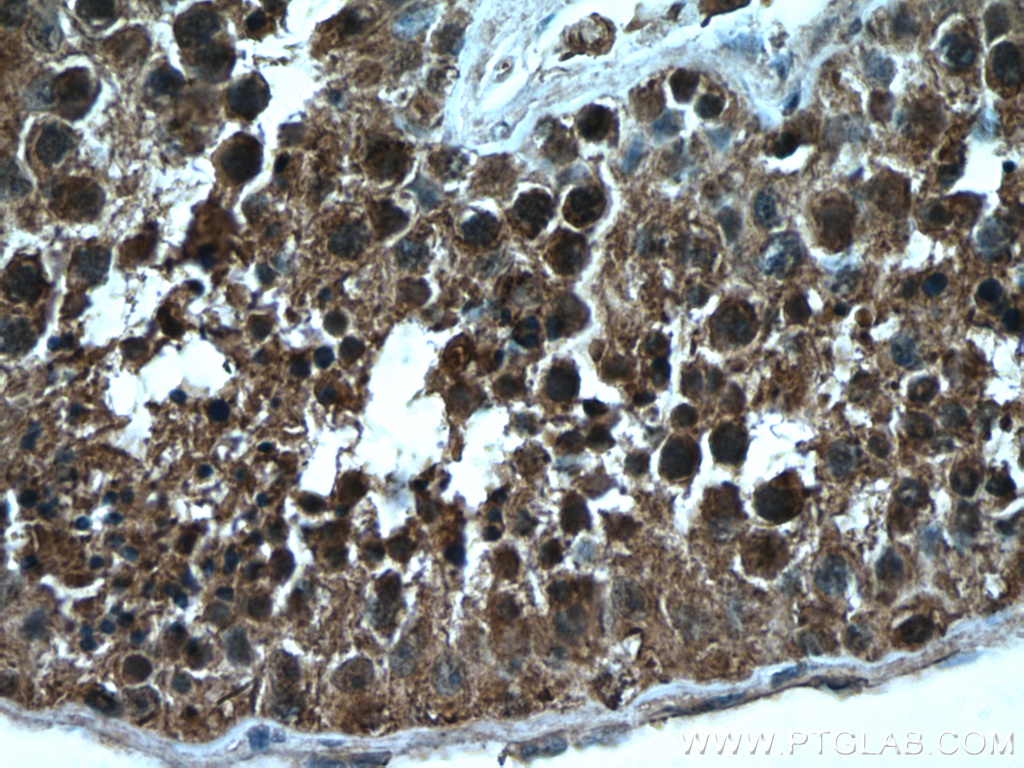 IHC staining of human testis using 66632-1-Ig