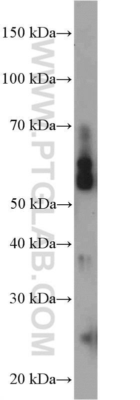 WB analysis of SH-SY5Y using 12843-1-AP