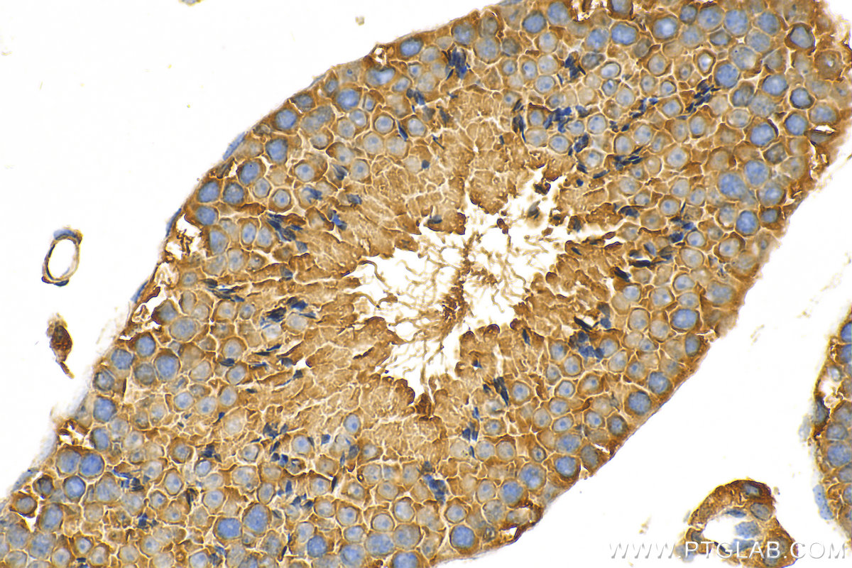 IHC staining of mouse testis using 31389-1-AP