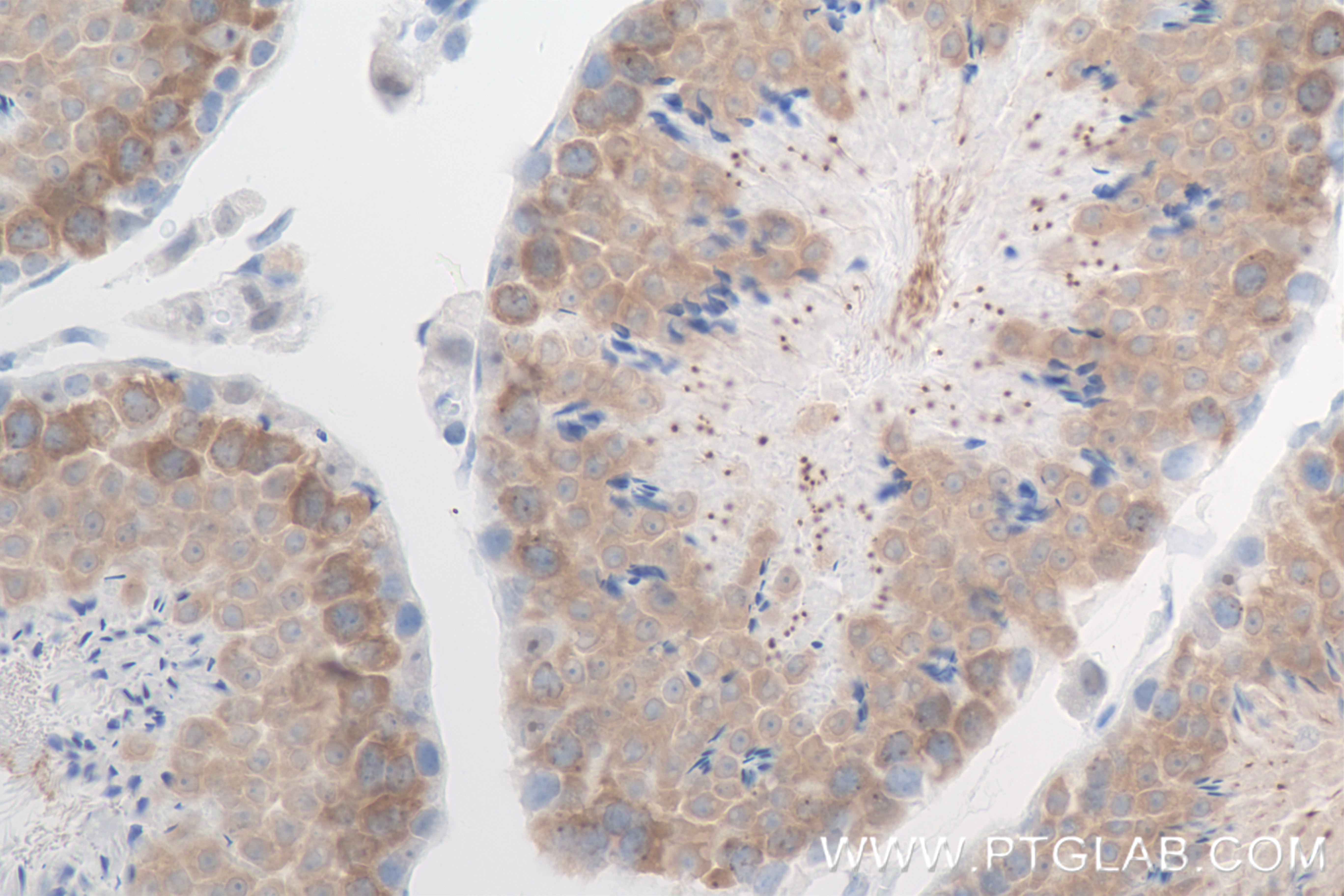 IHC staining of mouse testis using 84654-4-RR (same clone as 84654-4-PBS)