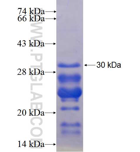 NEK5 fusion protein Ag24419 SDS-PAGE