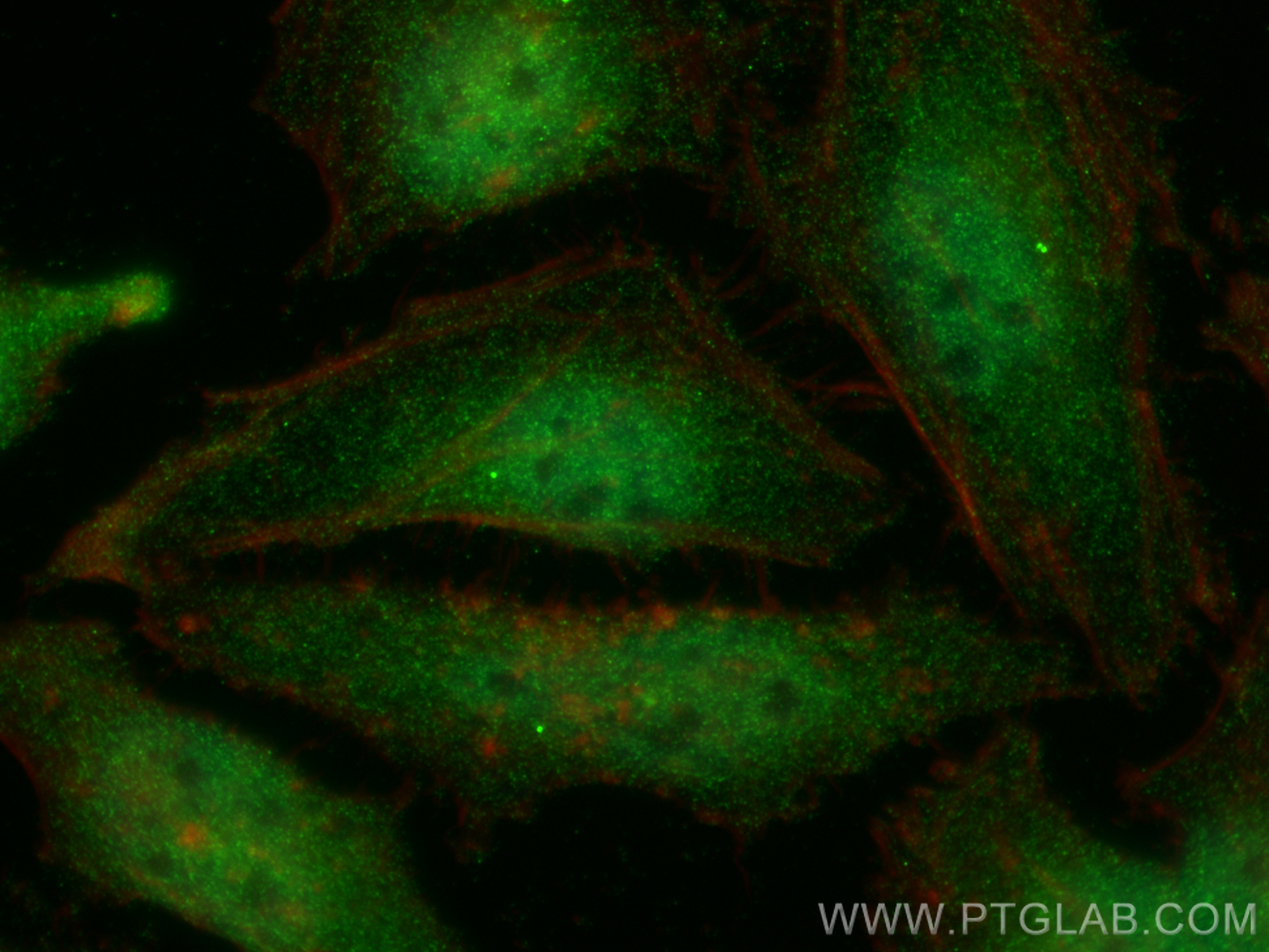 IF Staining of HeLa using 10378-1-AP