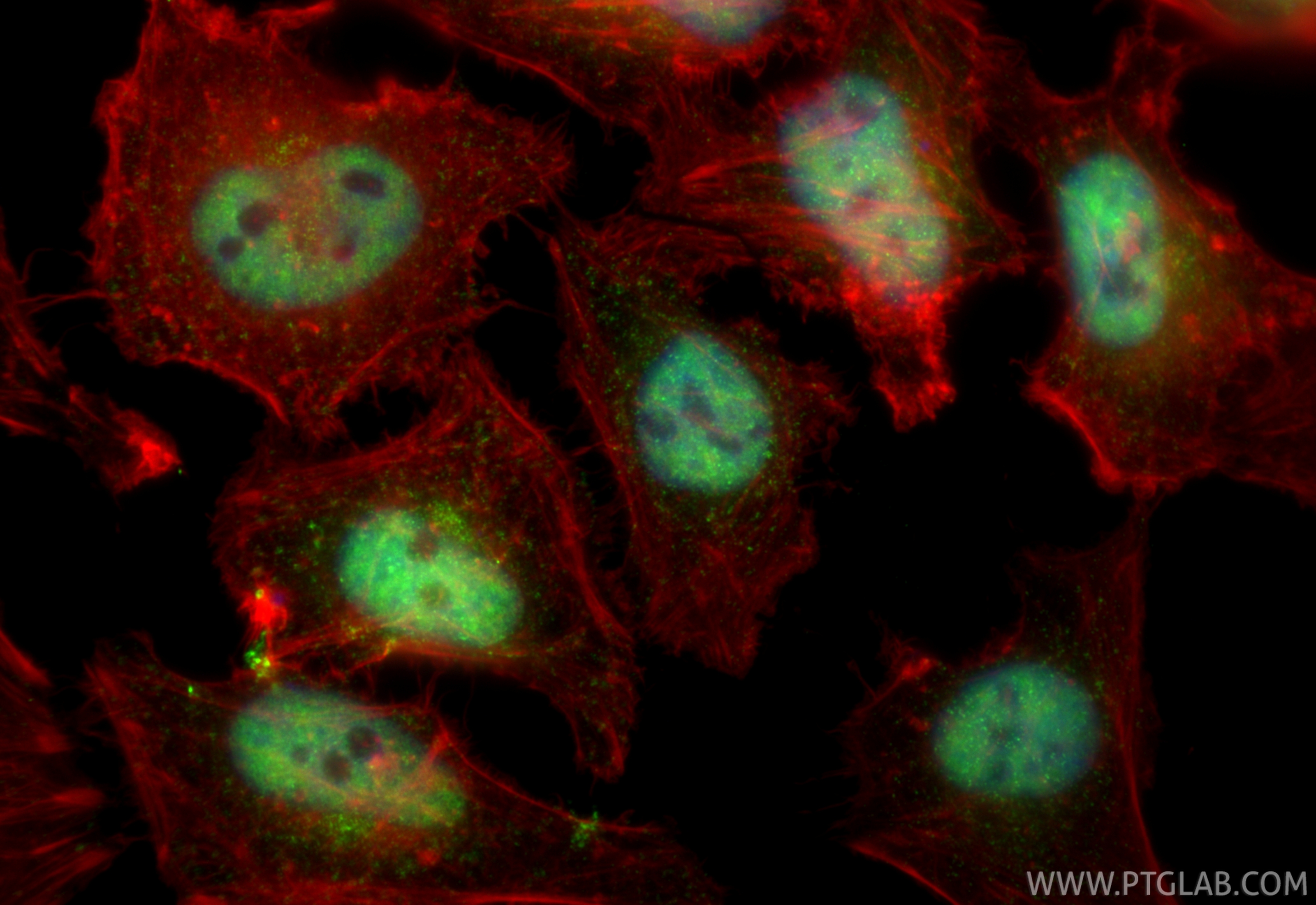 IF Staining of HeLa using 28070-1-AP