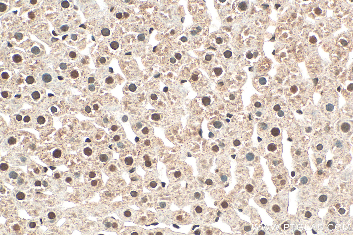 IHC staining of rat liver using 28070-1-AP