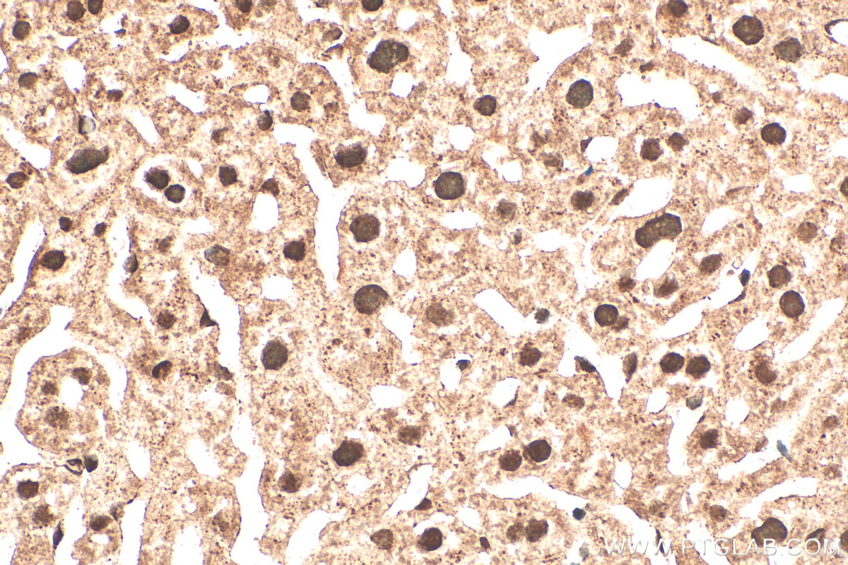 IHC staining of mouse liver using 28070-1-AP