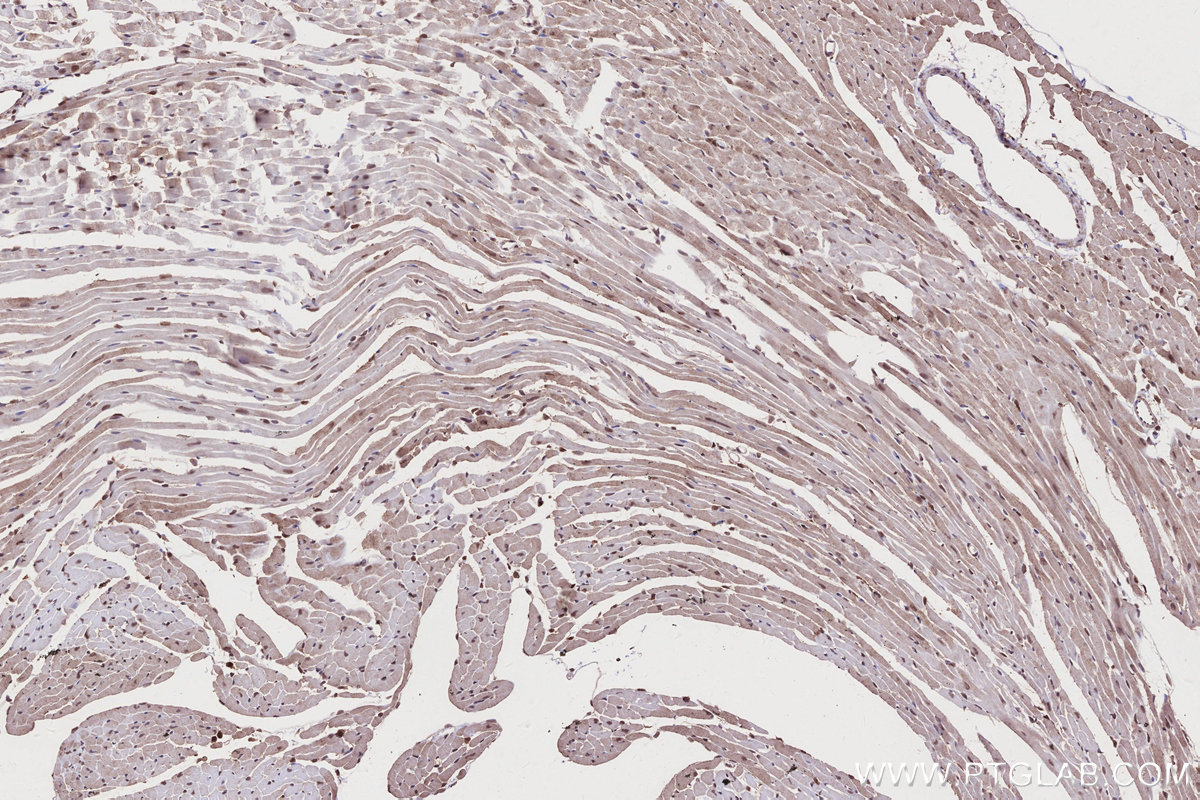 IHC staining of mouse heart using 31422-1-AP