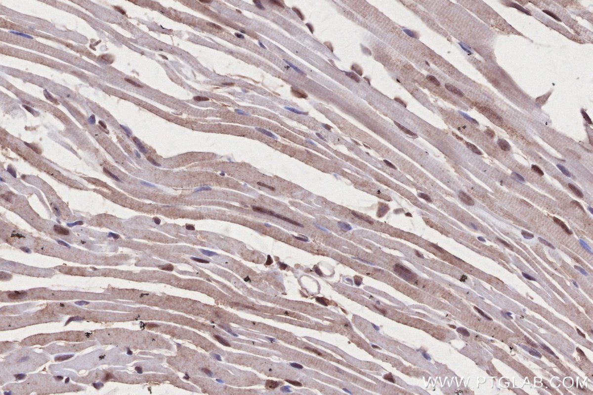 IHC staining of mouse heart using 31422-1-AP