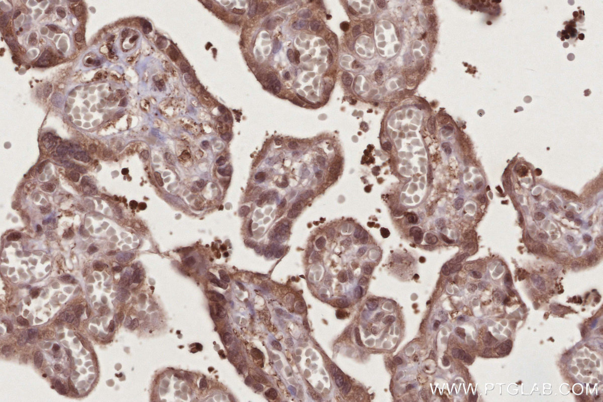 IHC staining of human placenta using 31422-1-AP IHC staining of human placenta using 31422-1-AP