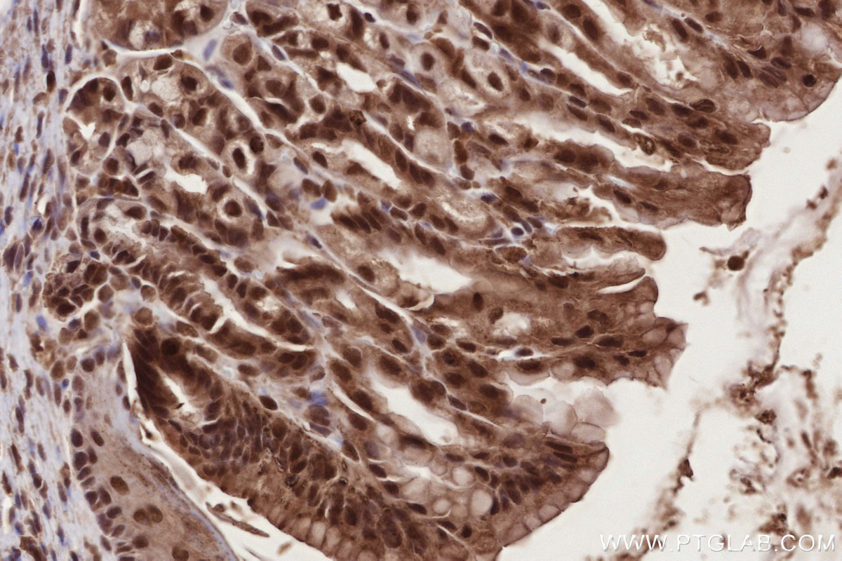 IHC staining of mouse stomach using 31422-1-AP IHC staining of mouse stomach using 31422-1-AP