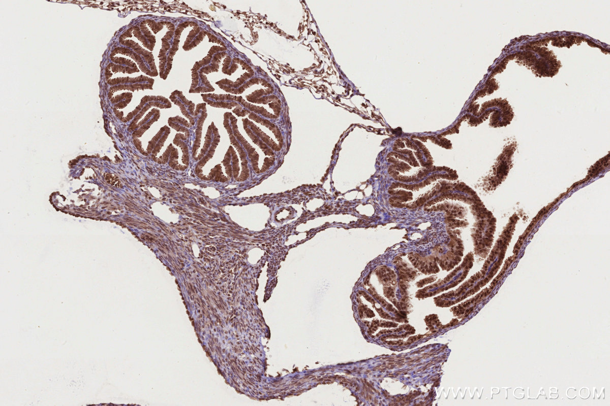 IHC staining of mouse ovary using 31422-1-AP IHC staining of mouse ovary using 31422-1-AP