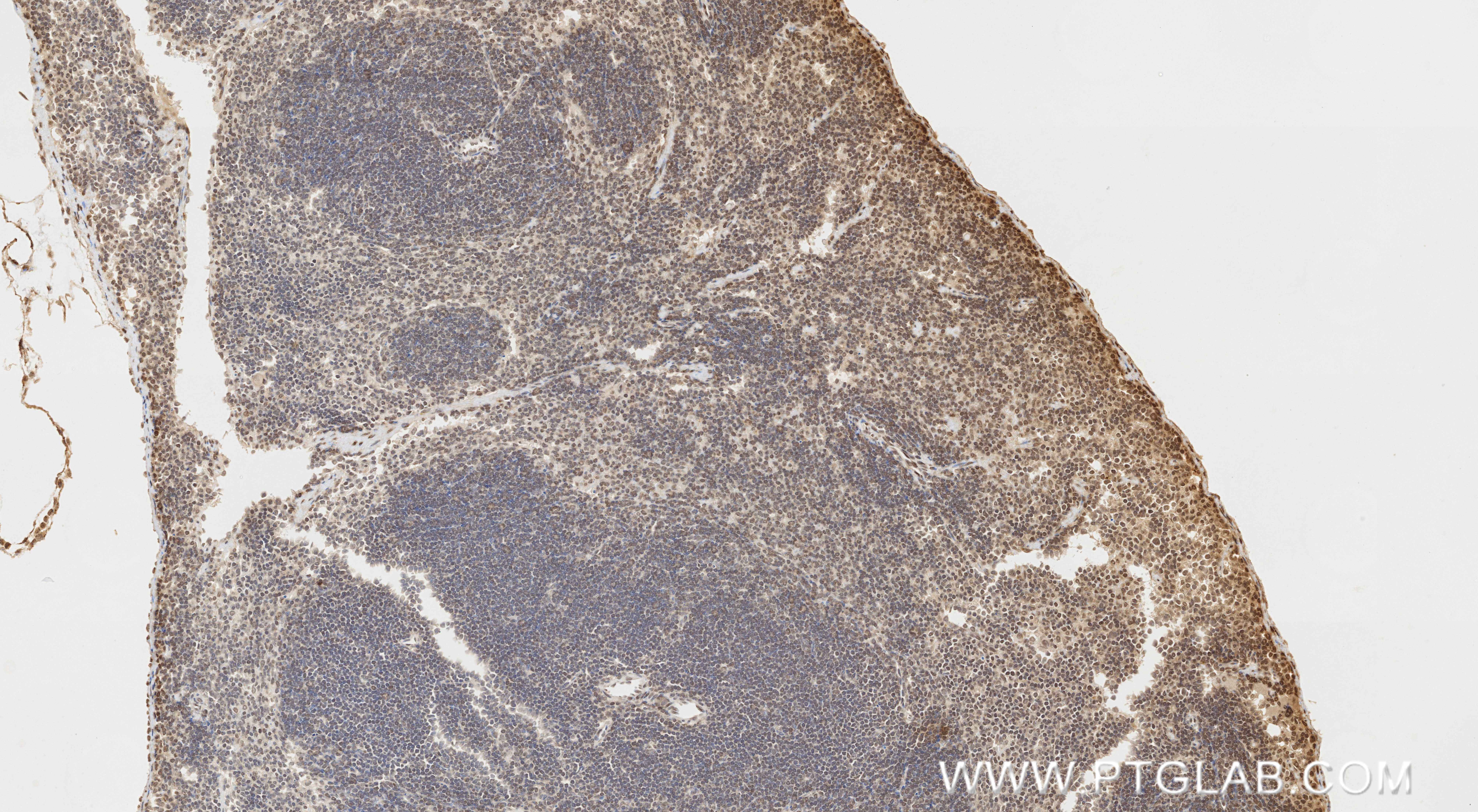 IHC staining of mouse spleen using 87253-1-RR IHC staining of mouse spleen using 87253-1-RR