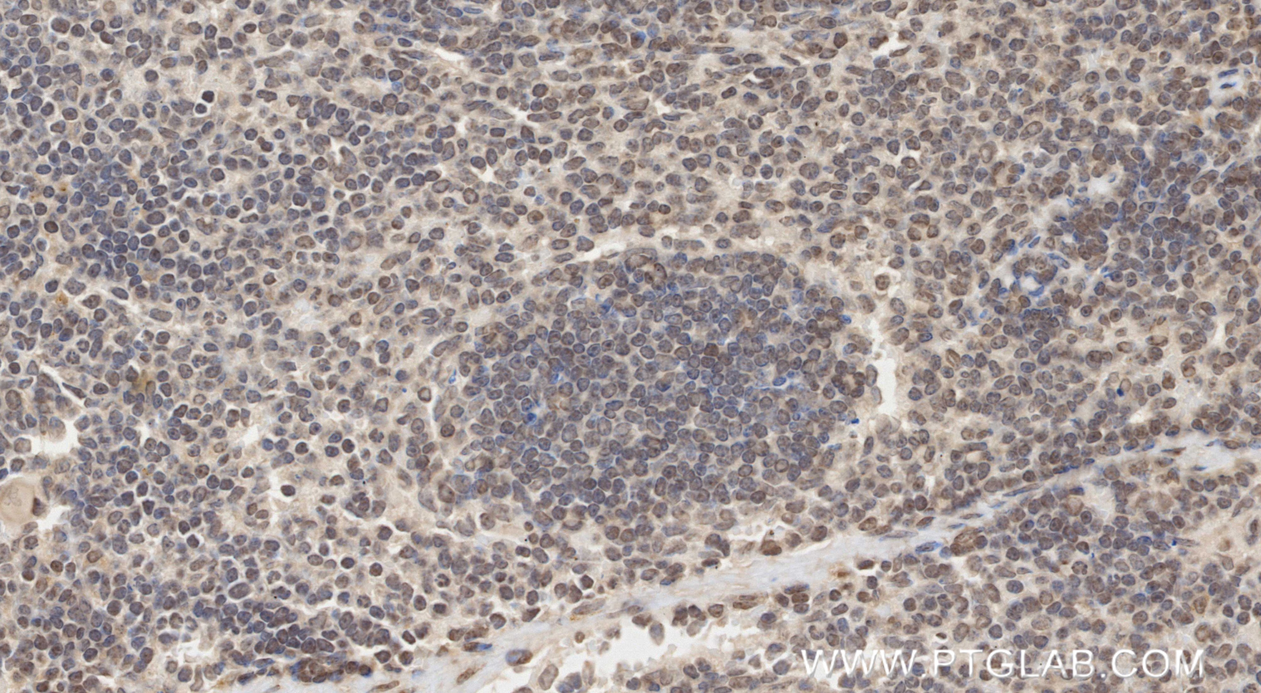 IHC staining of mouse spleen using 87253-1-RR IHC staining of mouse spleen using 87253-1-RR