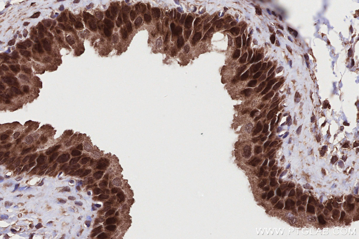 IHC staining of rat bladder using 11192-1-AP IHC staining of rat bladder using 11192-1-AP