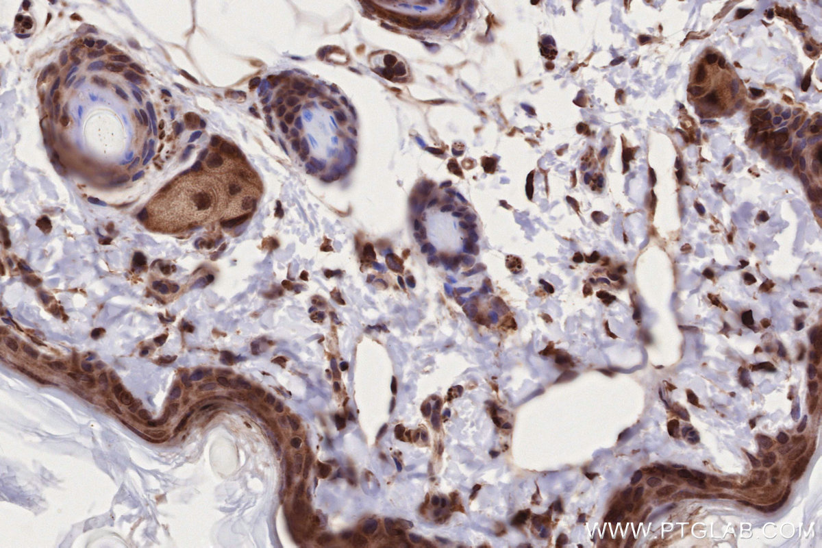 IHC staining of rat skin using 11192-1-AP IHC staining of rat skin using 11192-1-AP