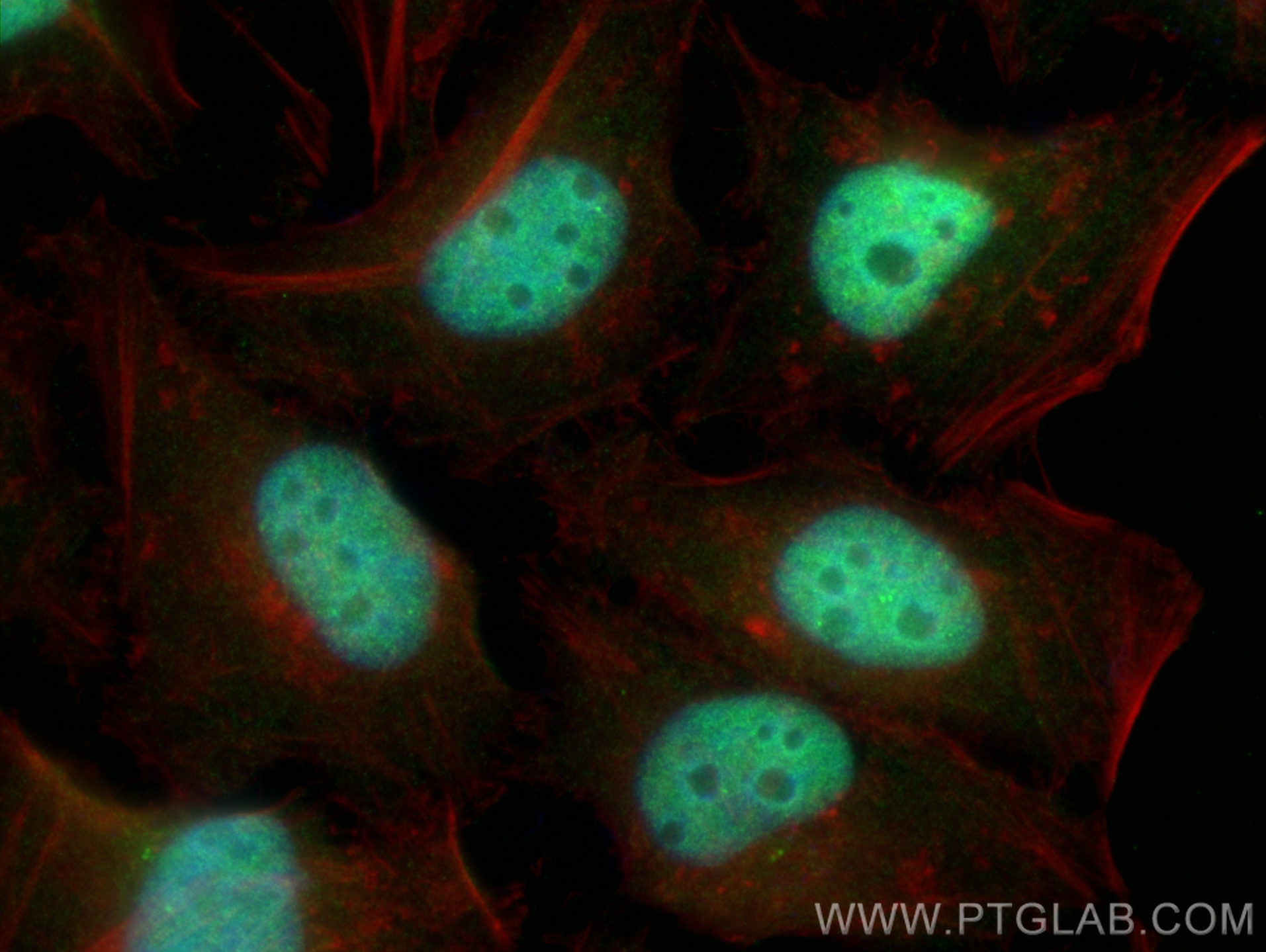 IF Staining of HeLa using 10456-1-AP