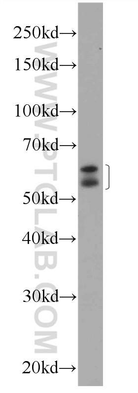 WB analysis of HeLa using 12244-1-AP