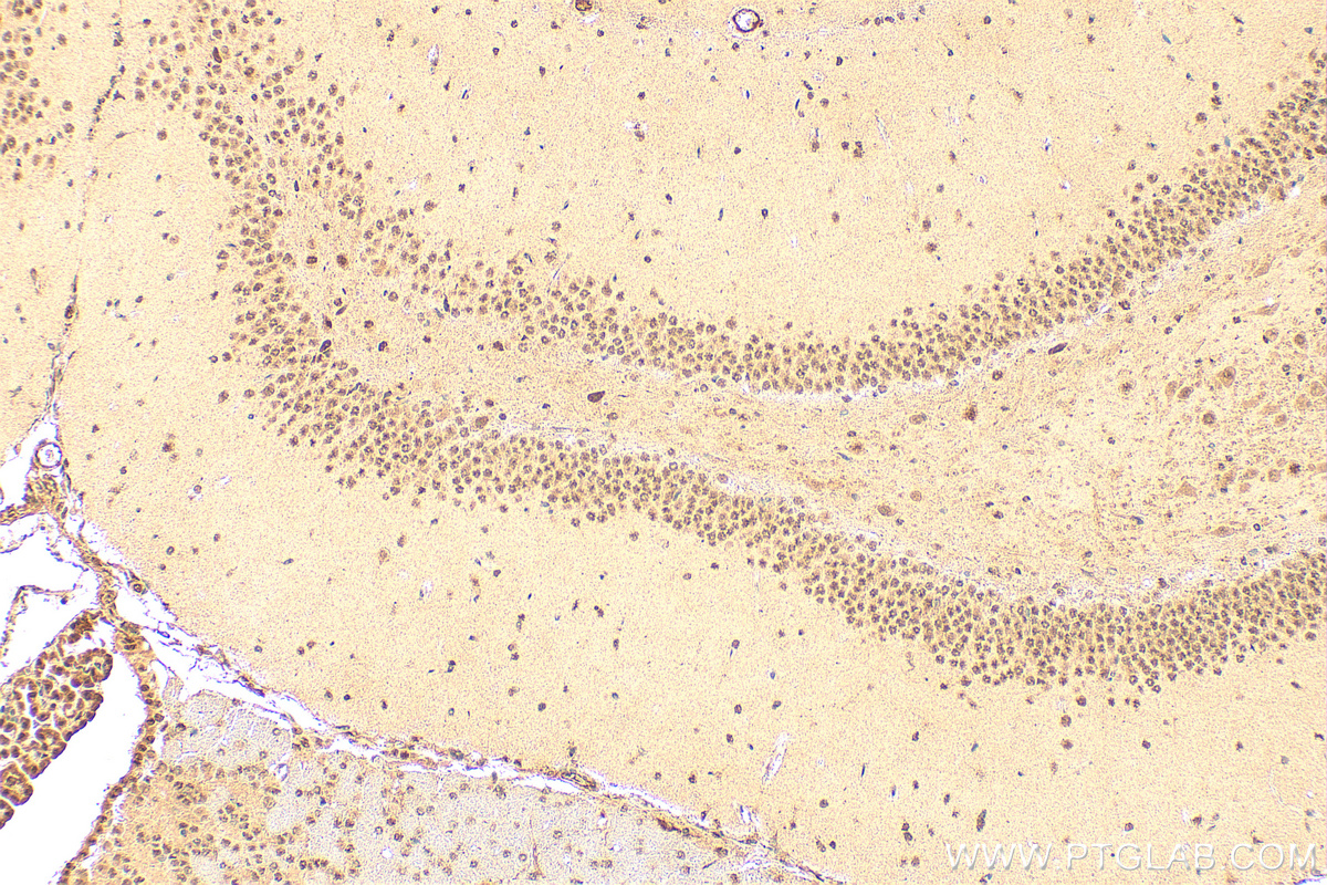 Immunohistochemical analysis of paraffin-embedded rat brain tissue slide using 16418-1-AP (NELFB antibody) at dilution of 1:200 (under 10x lens). Heat mediated antigen retrieval with Tris-EDTA buffer (pH 9.0). IHC staining of rat brain using 16418-1-AP