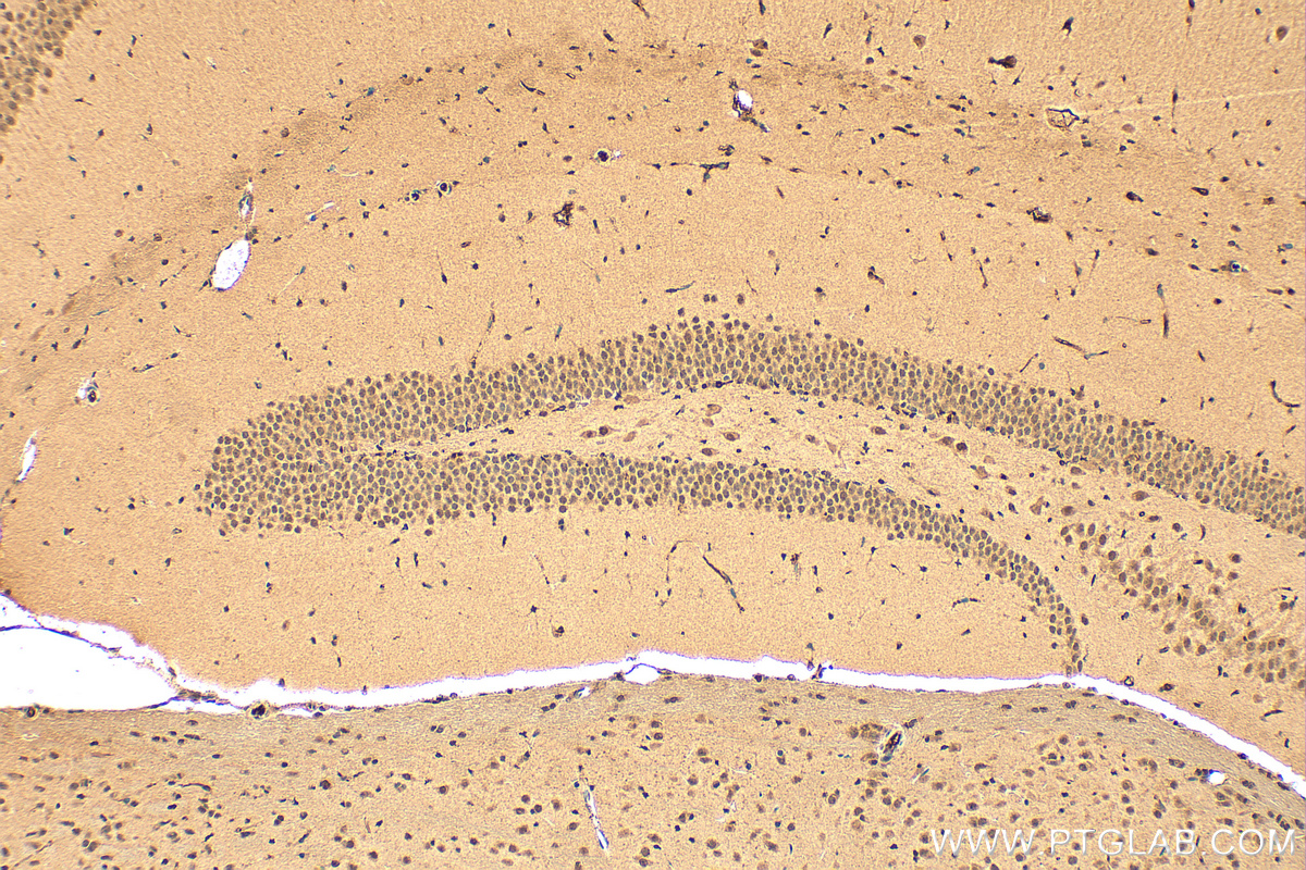 Immunohistochemical analysis of paraffin-embedded mouse brain tissue slide using 16418-1-AP (NELFB antibody) at dilution of 1:200 (under 10x lens). Heat mediated antigen retrieval with Tris-EDTA buffer (pH 9.0). IHC staining of mouse brain using 16418-1-AP