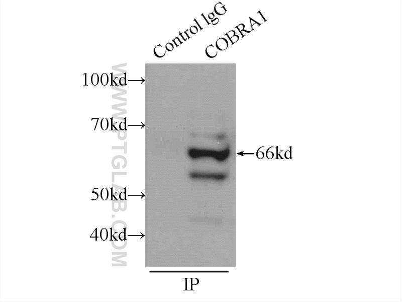 IP experiment of mouse brain using 16418-1-AP