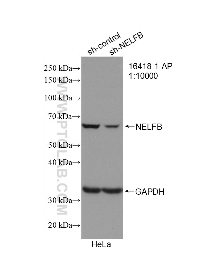 WB analysis of HeLa using 16418-1-AP