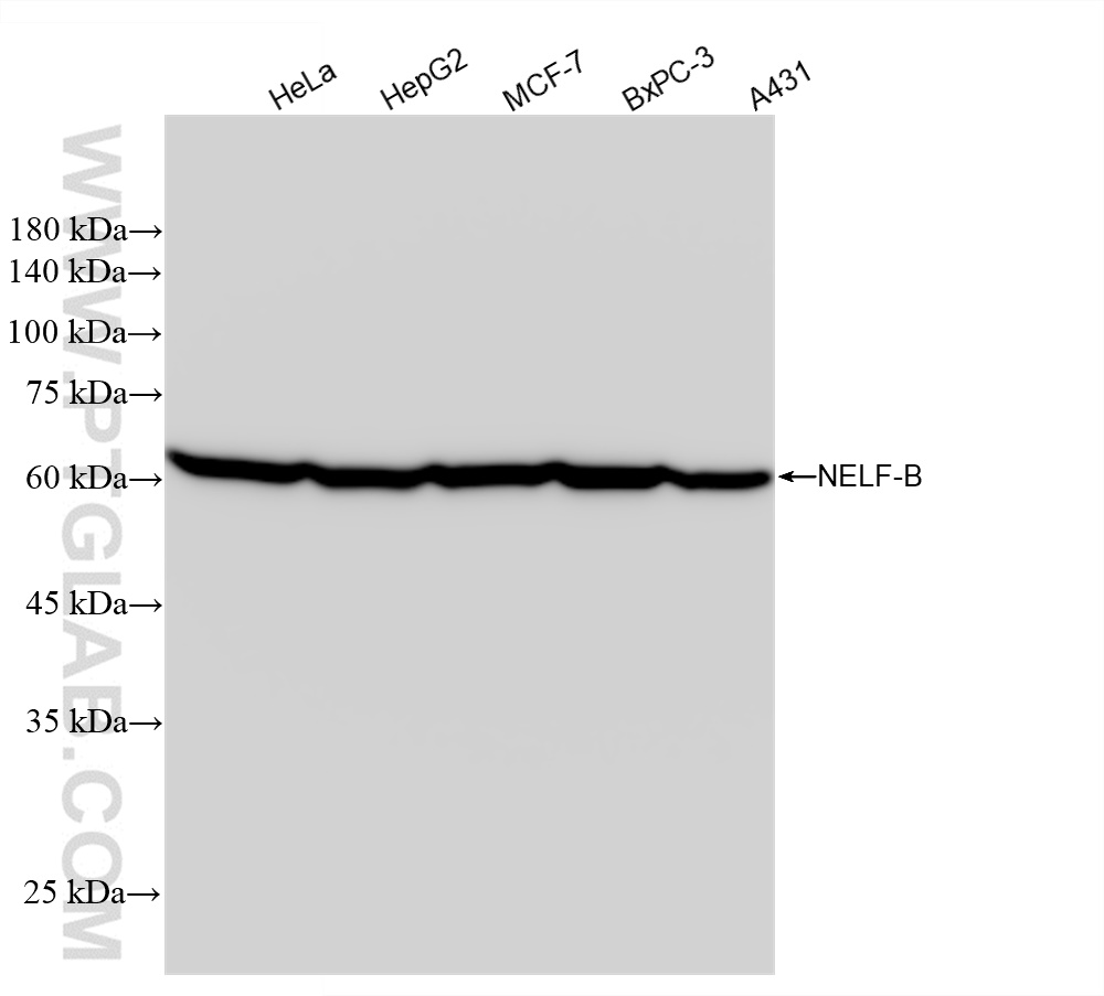 WB analysis using 84135-4-RR