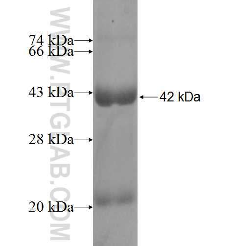NELF-B fusion protein Ag9237 SDS-PAGE NELF-B fusion protein Ag9237 SDS-PAGE