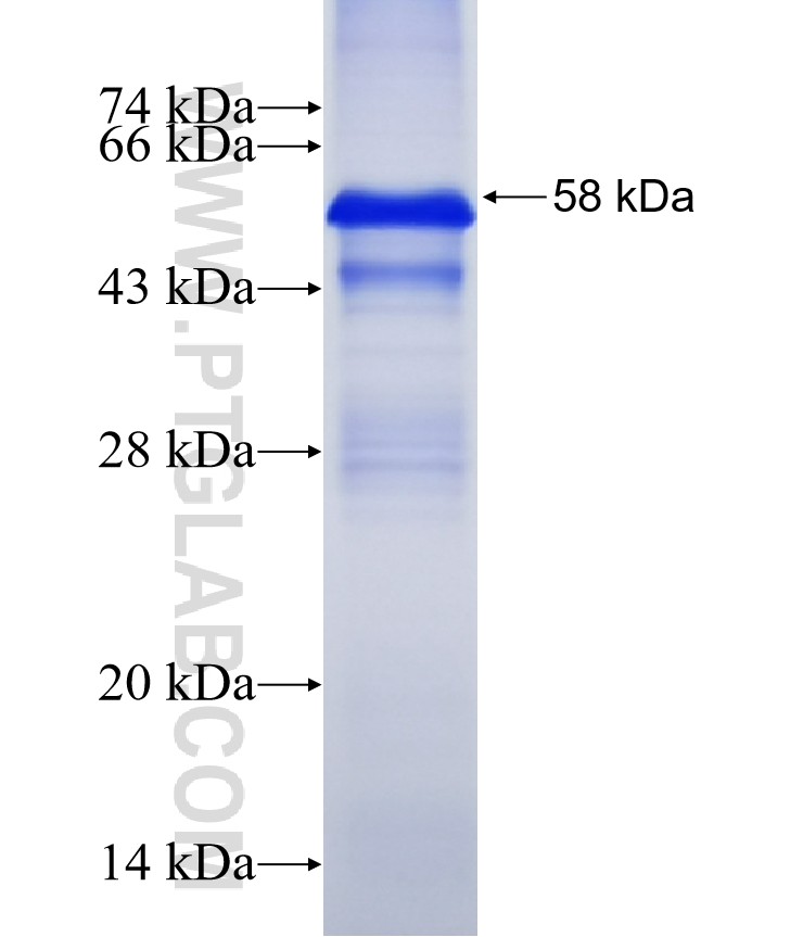 NELL1 fusion protein Ag15602 SDS-PAGE NELL1 fusion protein Ag15602 SDS-PAGE