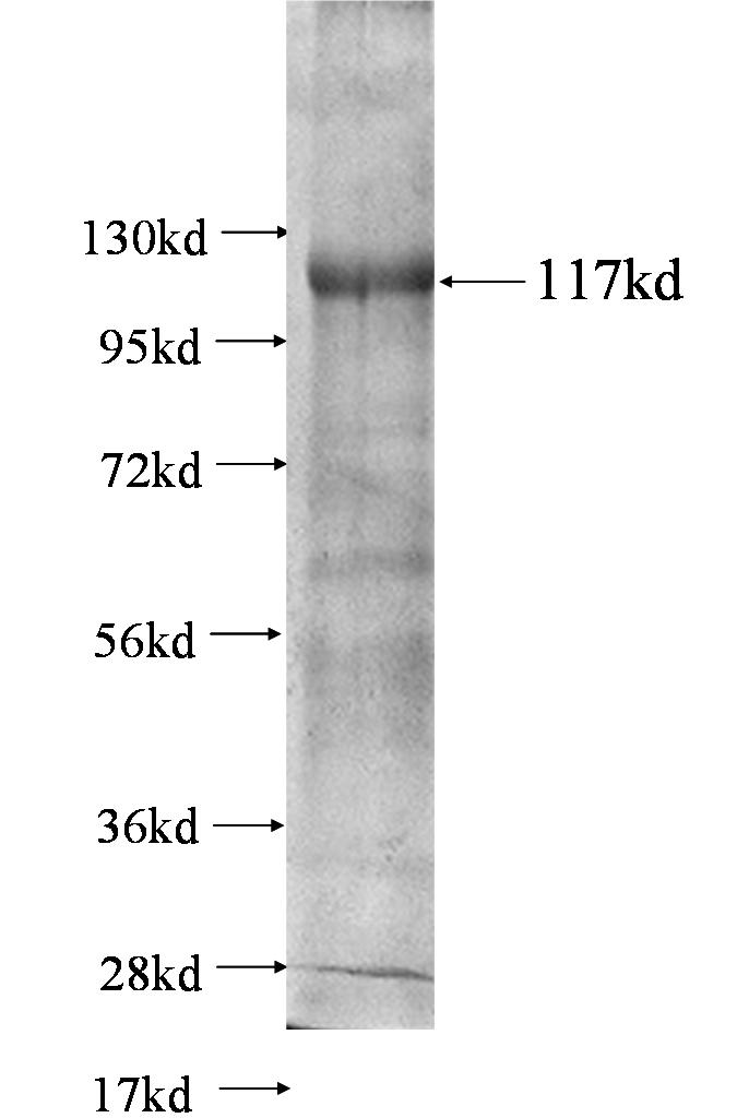 NELL2 fusion protein Ag0703 SDS-PAGE NELL2 fusion protein Ag0703 SDS-PAGE