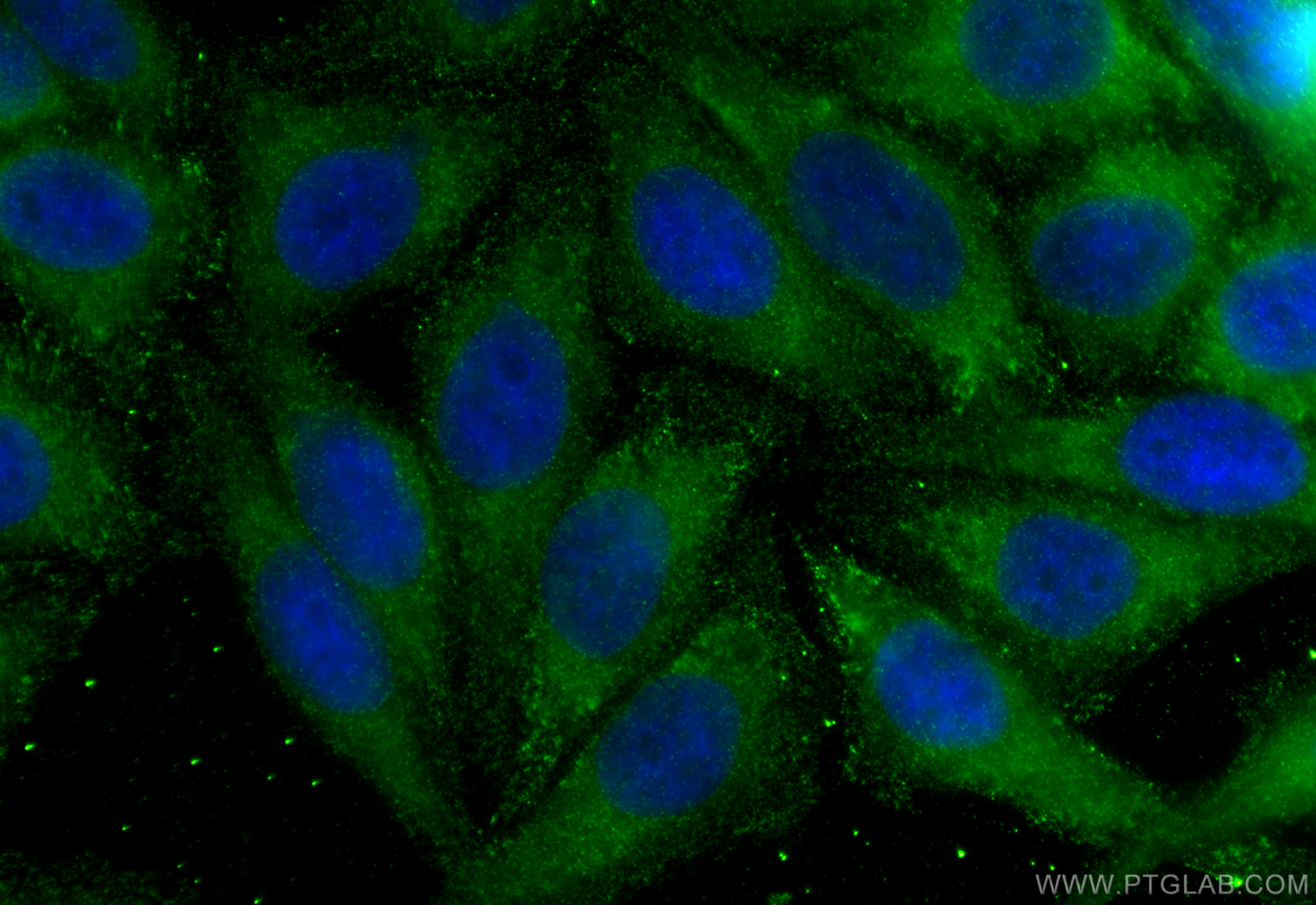 IF Staining of HepG2 using 60131-1-Ig