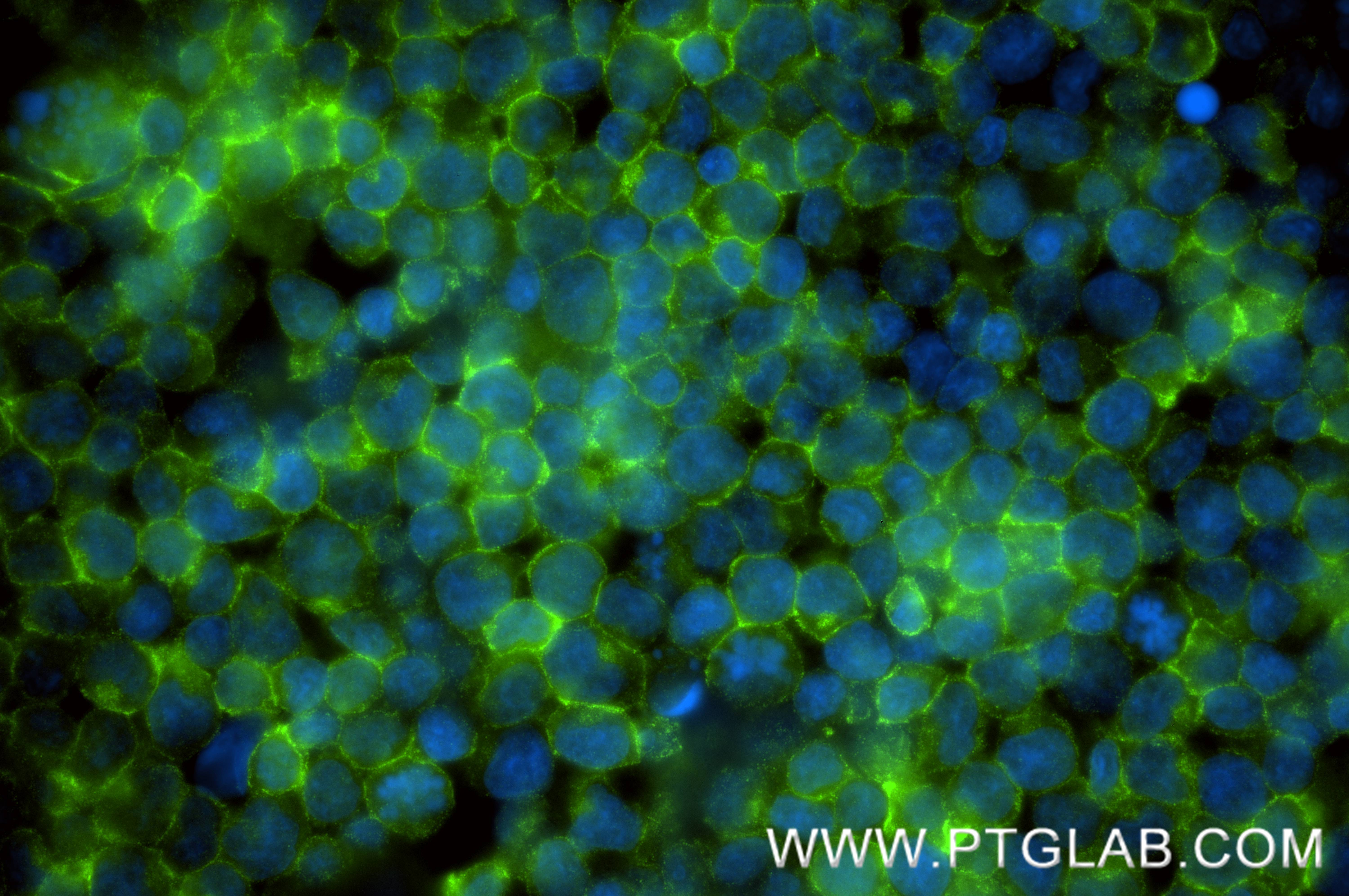 IF Staining of Jurkat using 88292-1-RR (same clone as 88292-1-PBS) IF Staining of Jurkat using 88292-1-RR (same clone as 88292-1-PBS)
