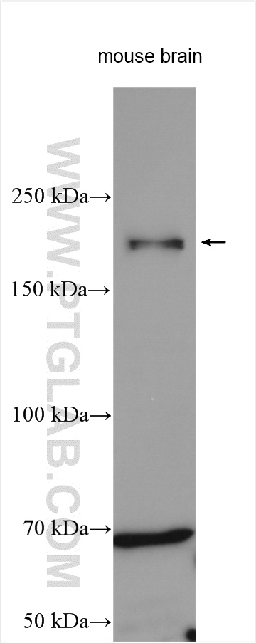 WB analysis using 19483-1-AP