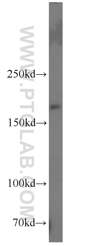 Nestin Polyclonal antibody