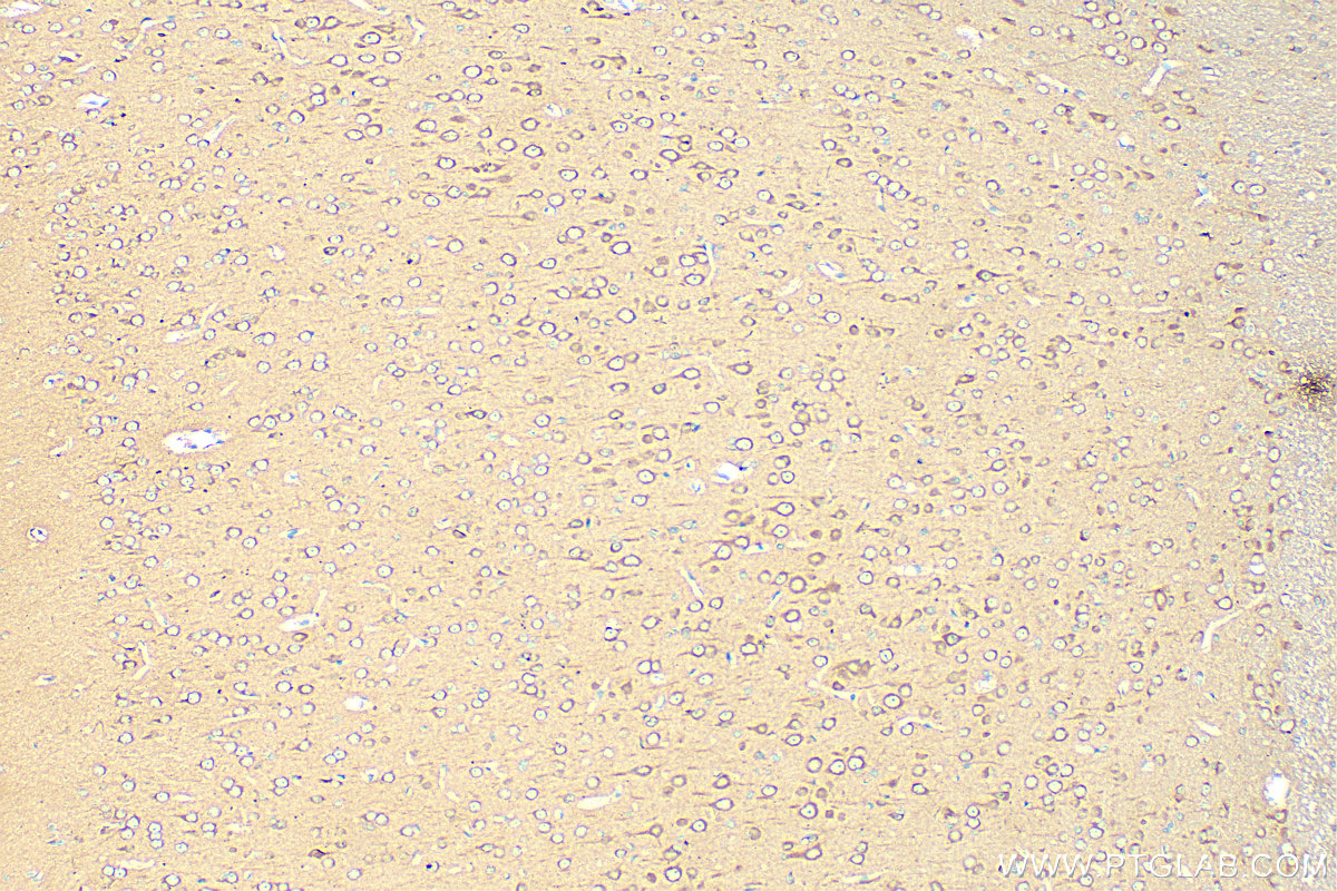 IHC staining of rat brain using 30760-1-AP