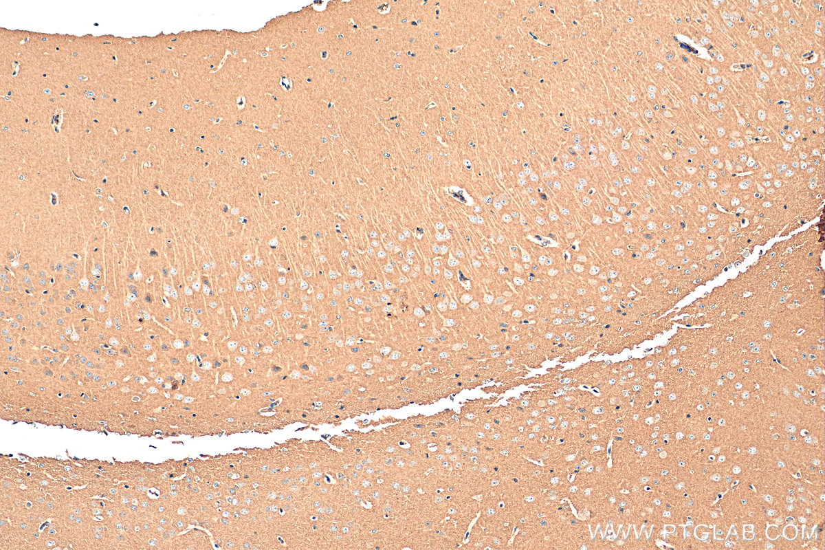 IHC staining of mouse brain using 10150-2-AP