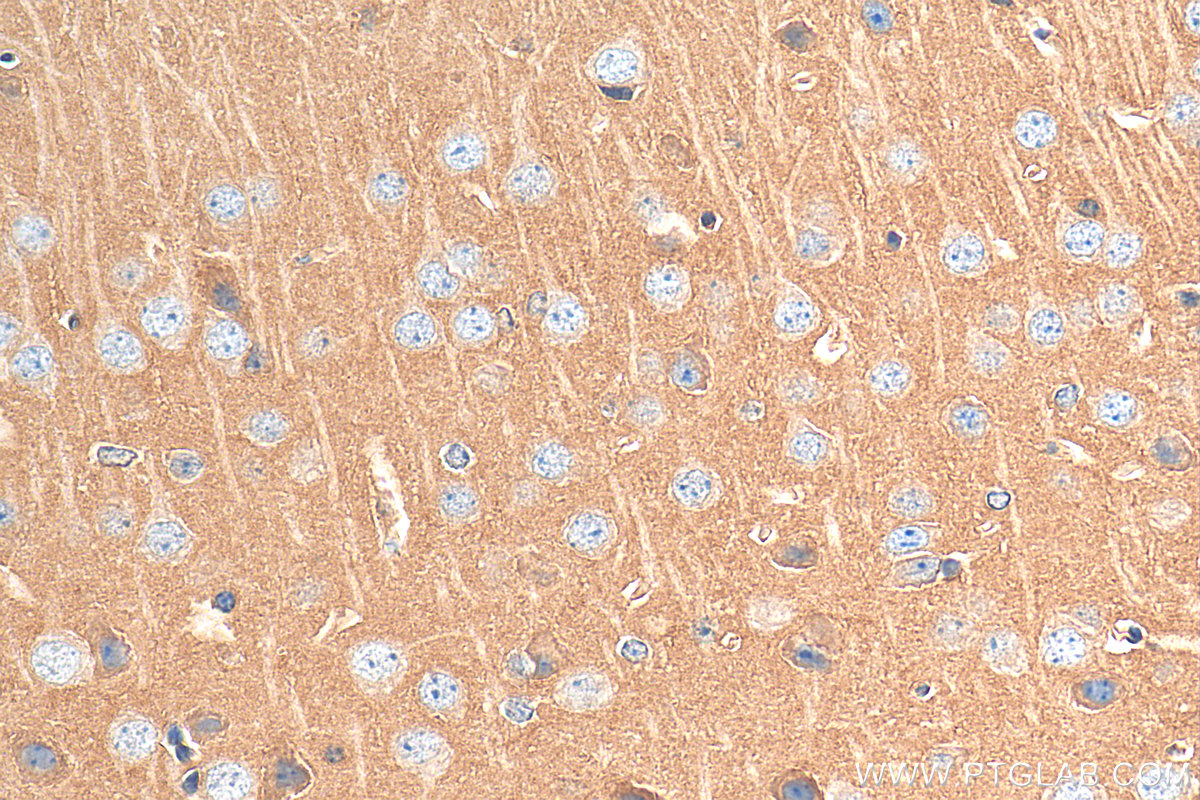 IHC staining of mouse brain using 10150-2-AP