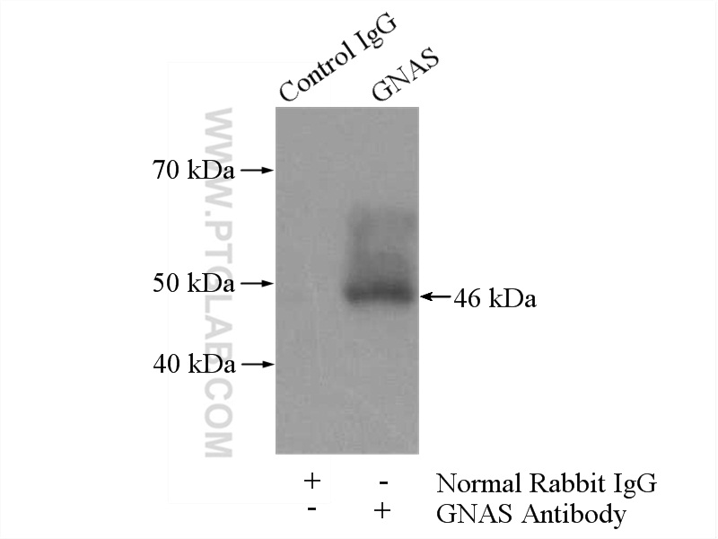 IP experiment of mouse liver using 10150-2-AP