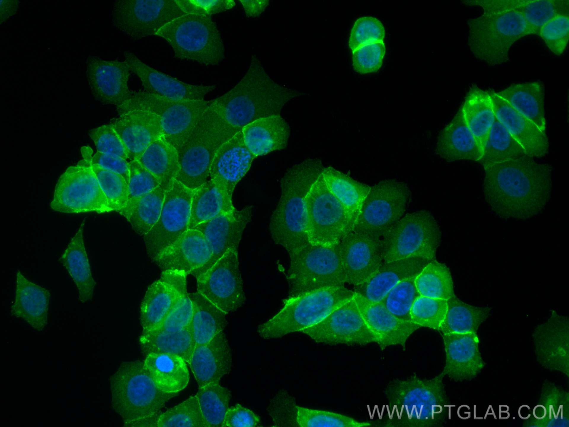 IF Staining of MCF-7 using 66253-1-Ig