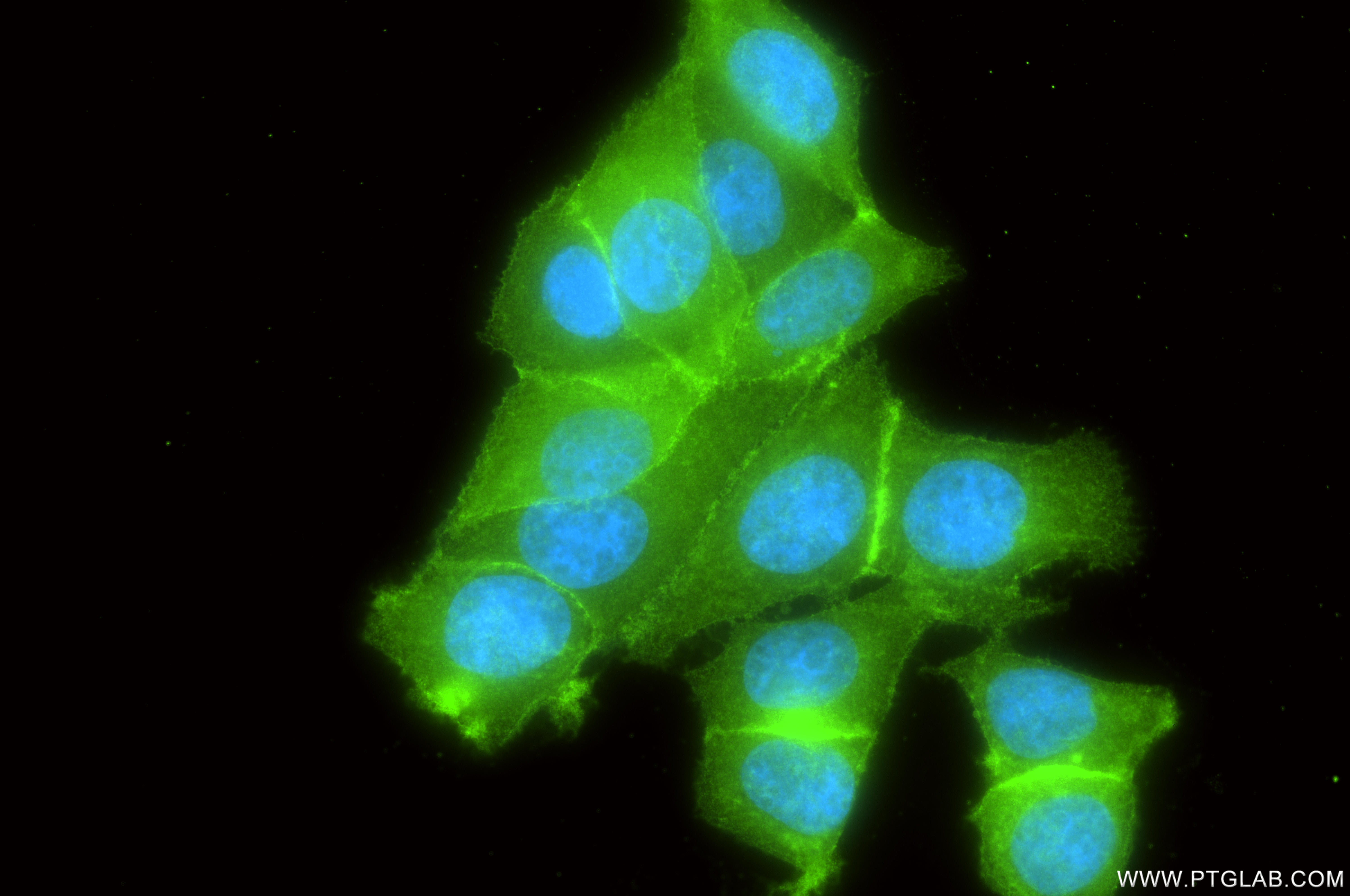 IF Staining of MCF-7 using 81802-2-RR (same clone as 81802-2-PBS) IF Staining of MCF-7 using 81802-2-RR (same clone as 81802-2-PBS)