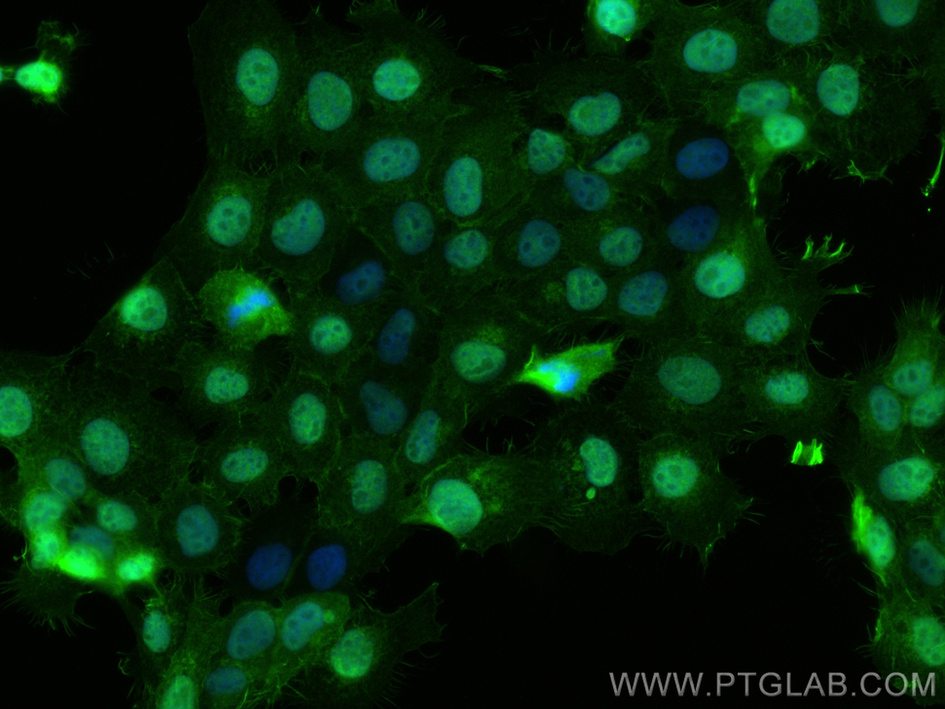 IF Staining of A431 using 12740-1-AP