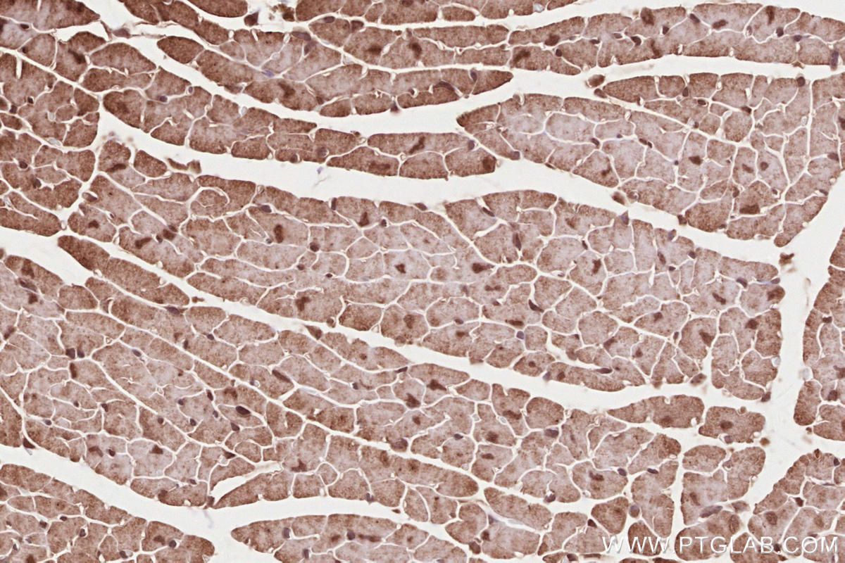IHC staining of mouse heart using 12740-1-AP