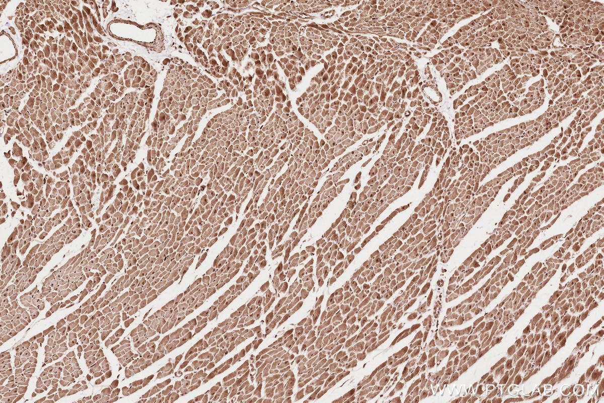 IHC staining of rat heart using 12740-1-AP