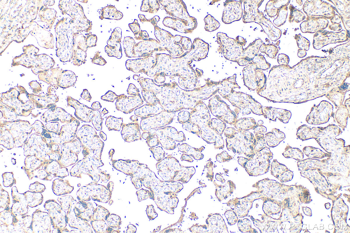 IHC staining of human placenta using 28167-1-AP